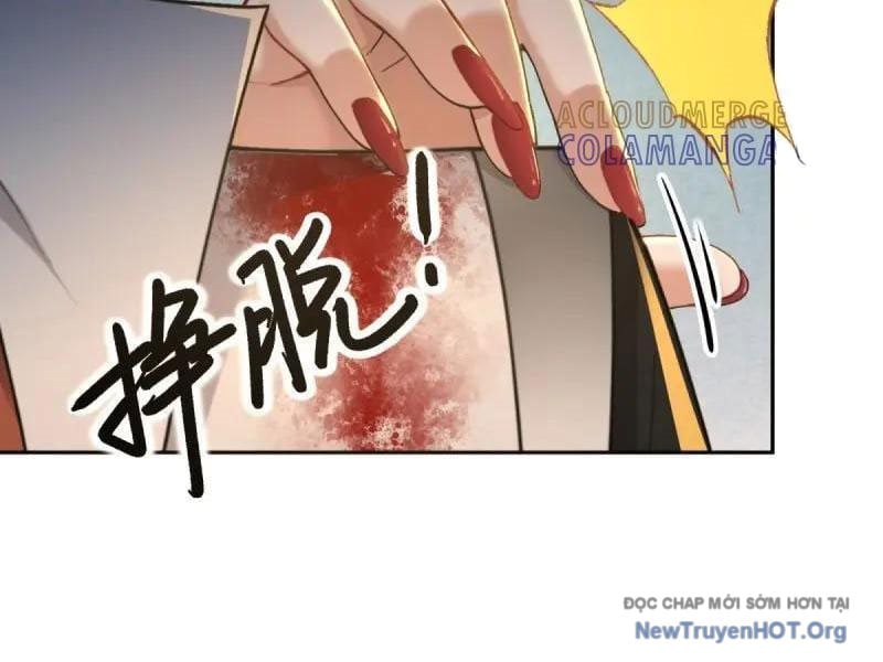 Bắt Đầu Với Tuyệt Sắc Sư Tôn: Hệ Thống Tổng Cục Phản Cốt: Chapter 175