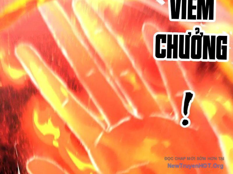 Gặp Mạnh Thì Càng Mạnh, Tu Vi Của Ta Không Giới Hạn: Chapter 65