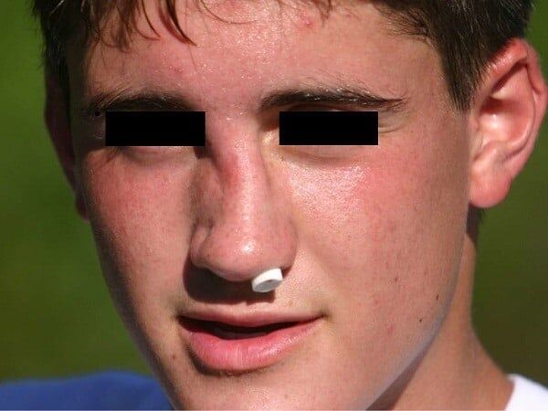 Hổ Đến Chơi Nhà (Puchimasu Miếu): Chapter 112