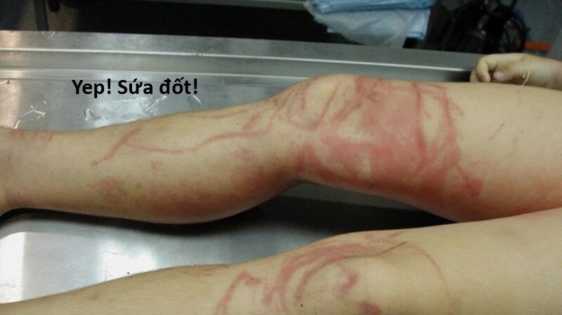 Hổ Đến Chơi Nhà (Puchimasu Miếu): Chapter 120