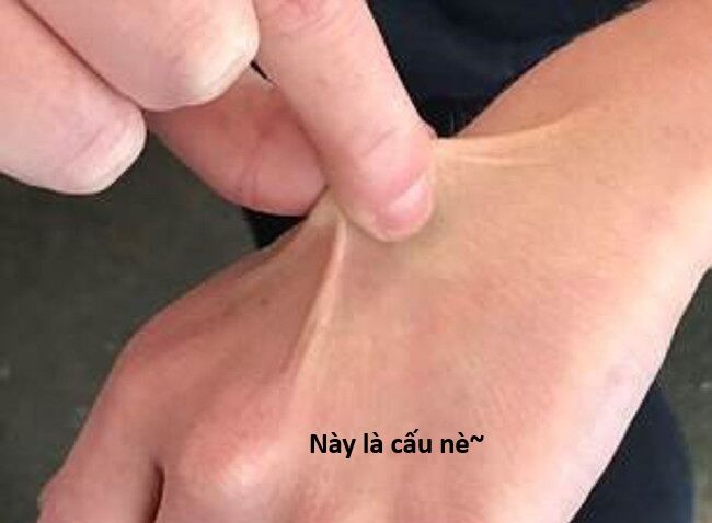 Hổ Đến Chơi Nhà (Puchimasu Miếu): Chapter 144