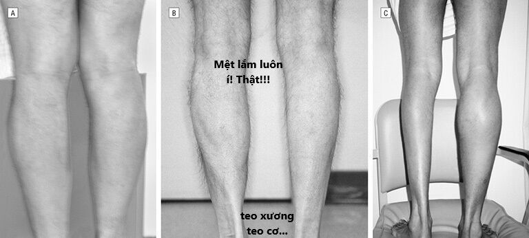 Ngay Cả Khi Hậu Tận Thế, Thật Hạnh Phúc Khi Vẫn Còn Được Sống... (Puchimasu Miếu): Chapter 42.2